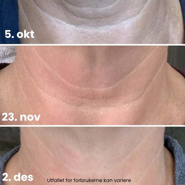 Vitae Charm Neck Cream