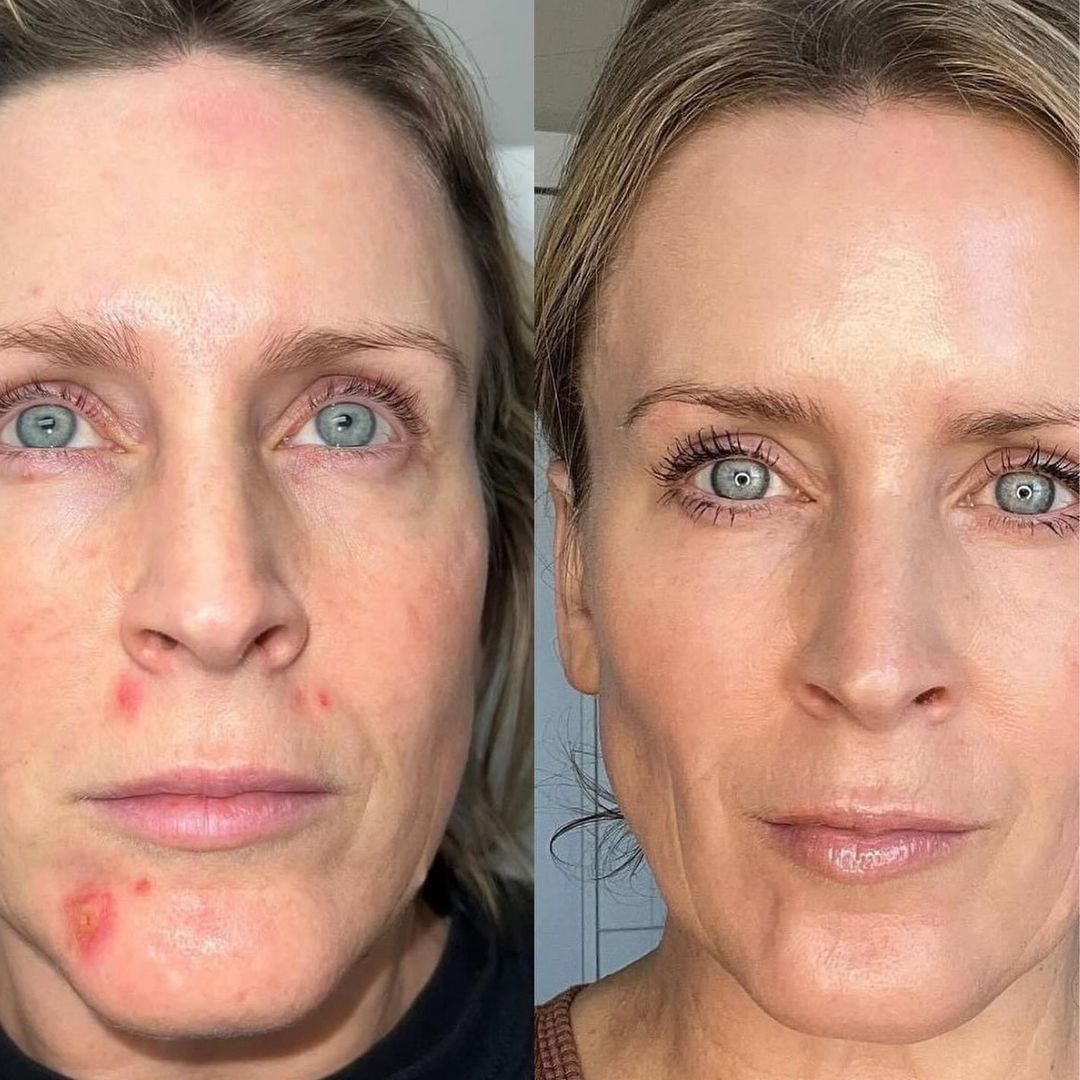 Color Changing Foundation