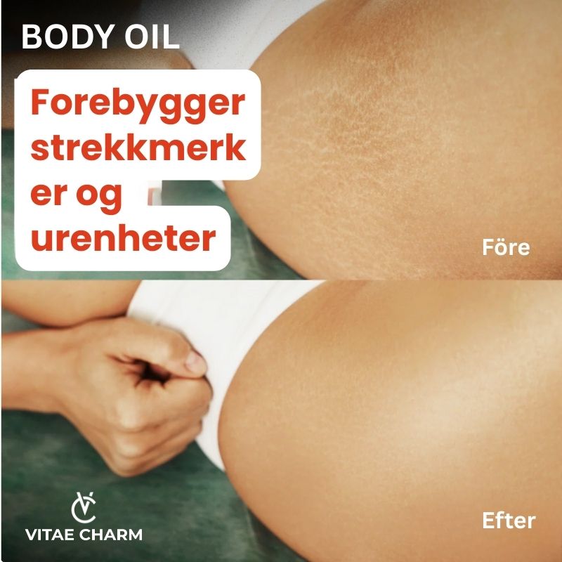 Vitae-Charm OilBody 100ml