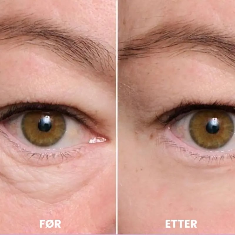 Dark Circles and Firming Cream med rødt lys